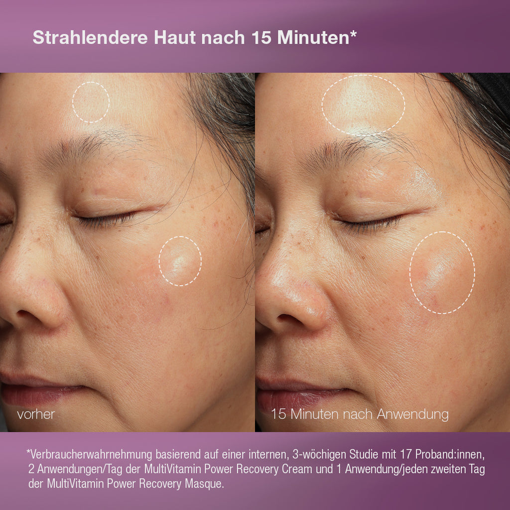 Stressed Skin Recovery System Kit