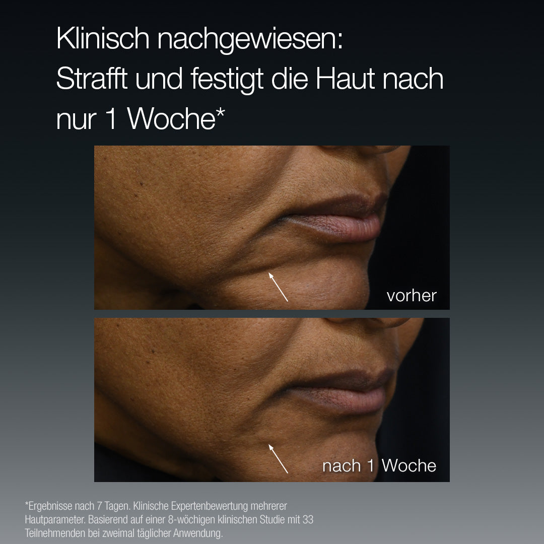 FutureCode Booster - Großer Deal