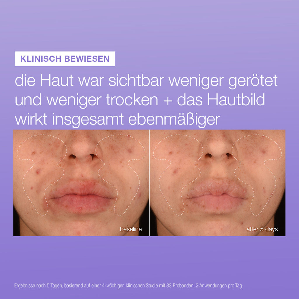 Stabilizing Repair Serum
