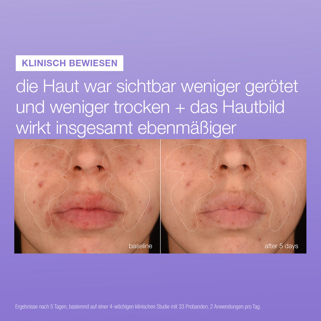 Stabilizing Repair Serum
