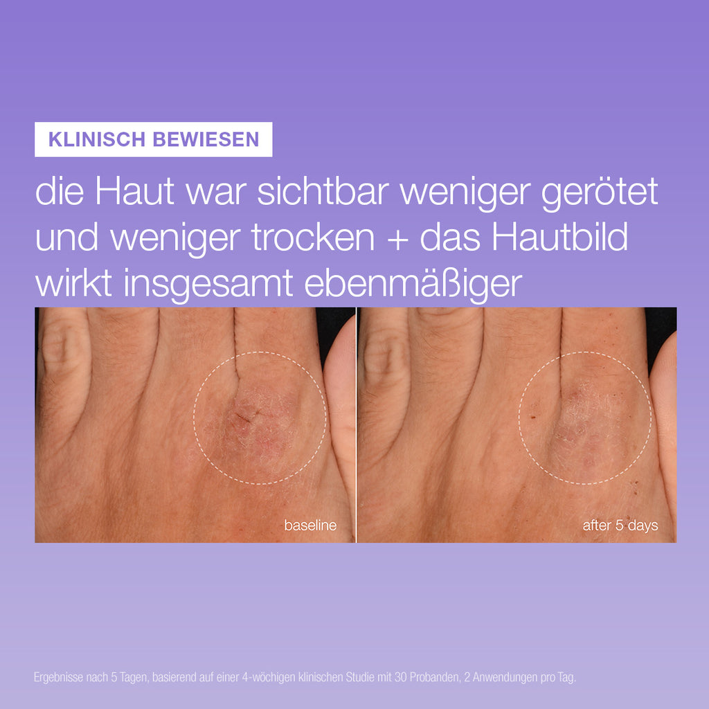 Stabilizing Repair Serum
