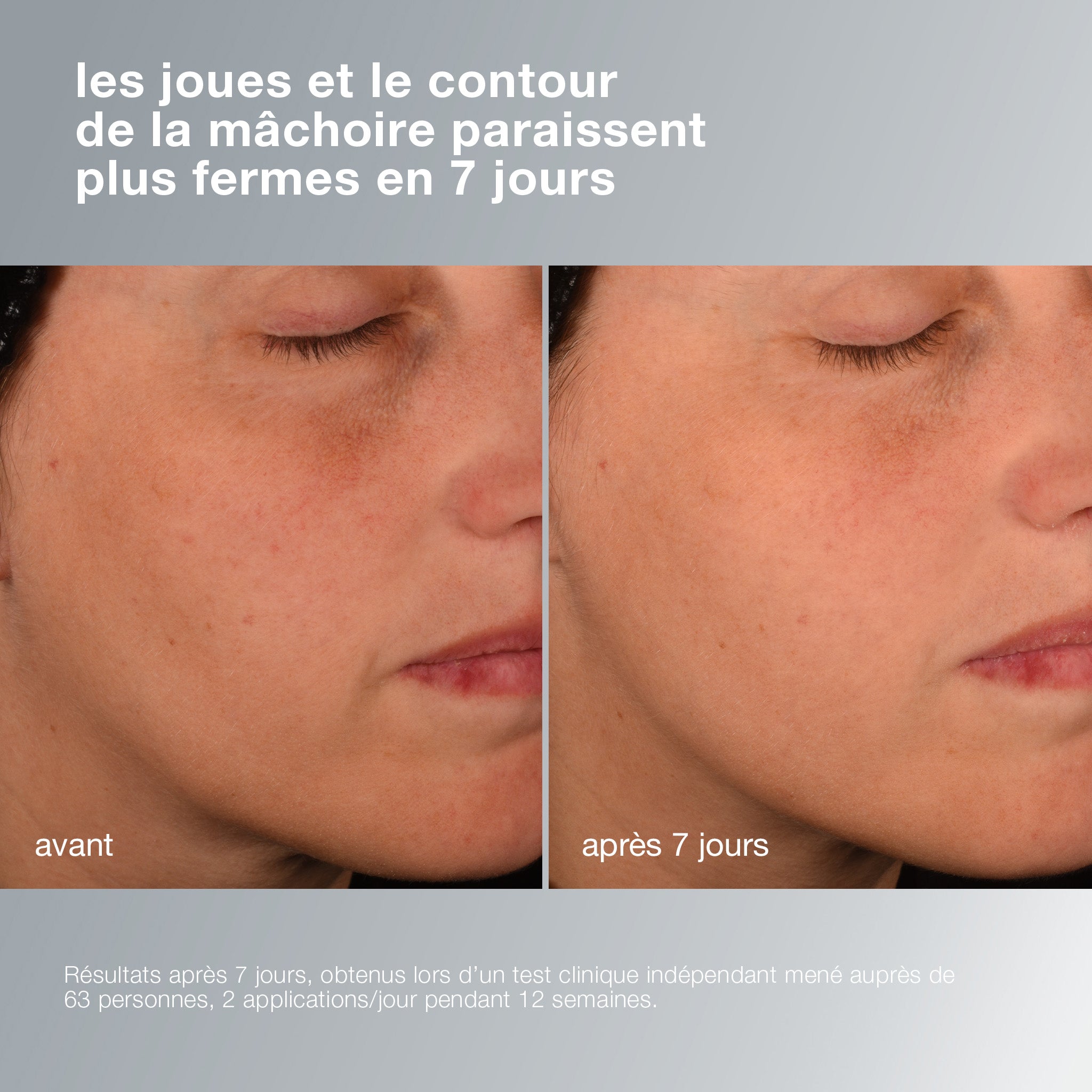 Sérum pro-collagène pour la conservation