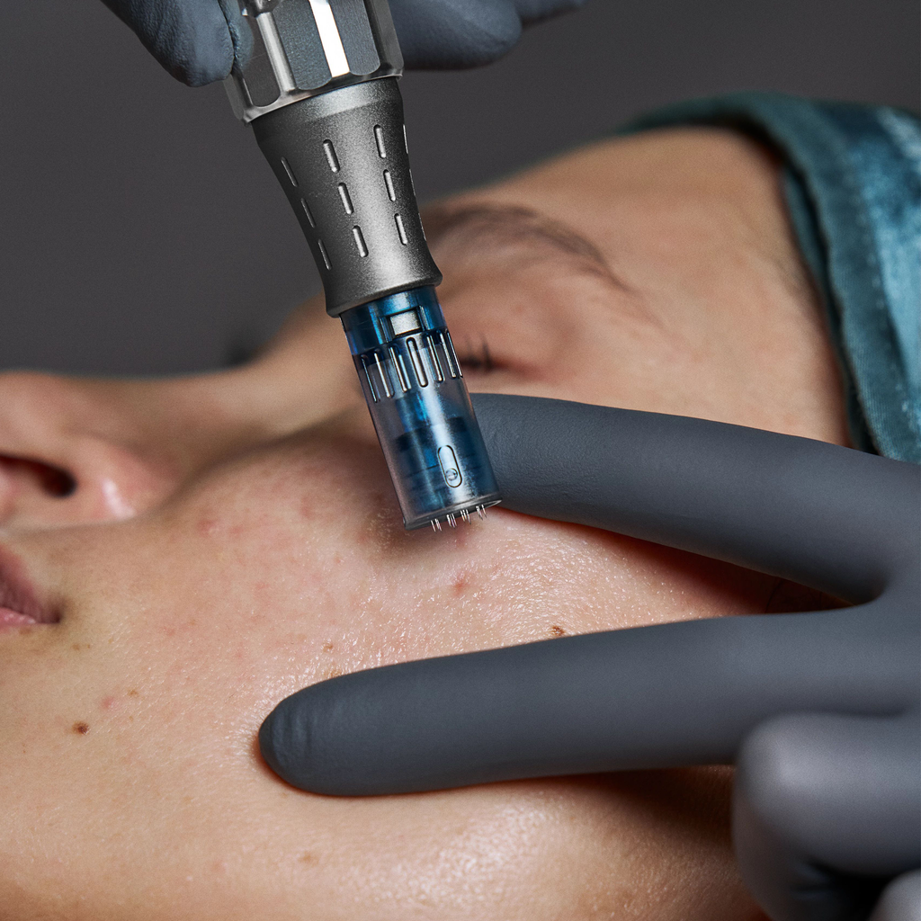 Pro Microneedling Pen 2